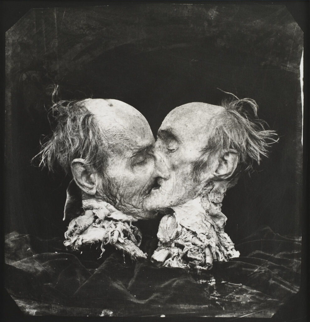 The Kiss, New Mexico, 1982 © Joel Peter Witkin.  Courtesy of Baudoin Lebon.